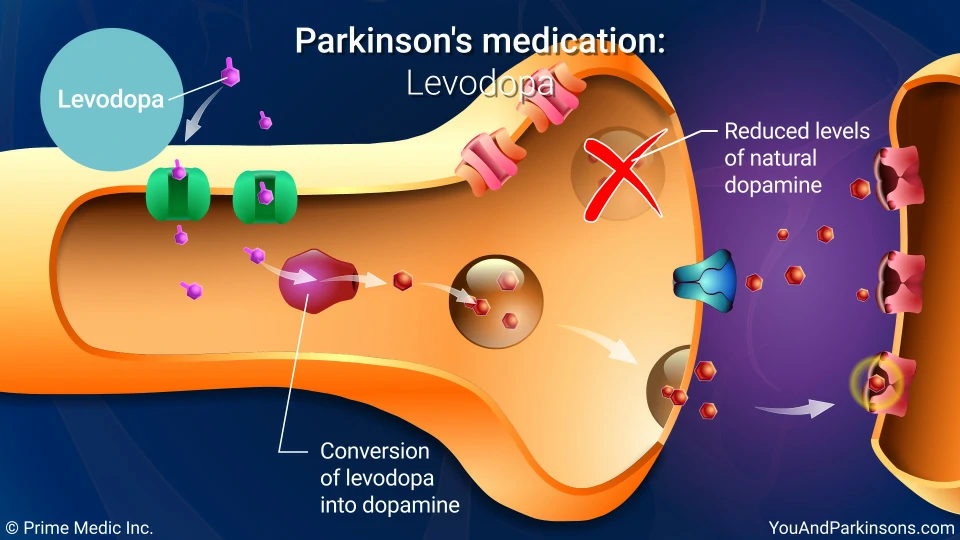 Parkinson's Disease Medication Options